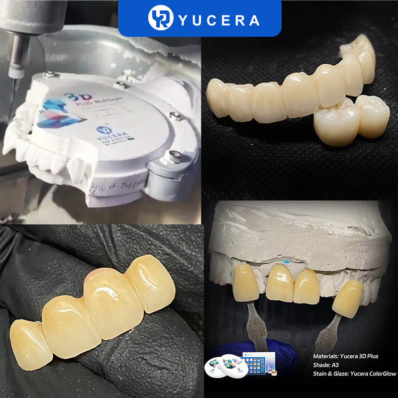 YUCERA Zirconia 3D Plus  Open System 98mm