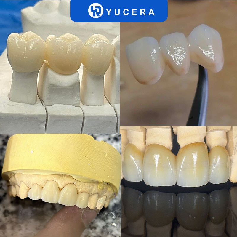 YUCERA Zirconia ST Multilayer  Open System 98mm