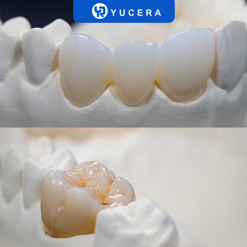 YUCERA Zirconia ST Color  Open System 98mm